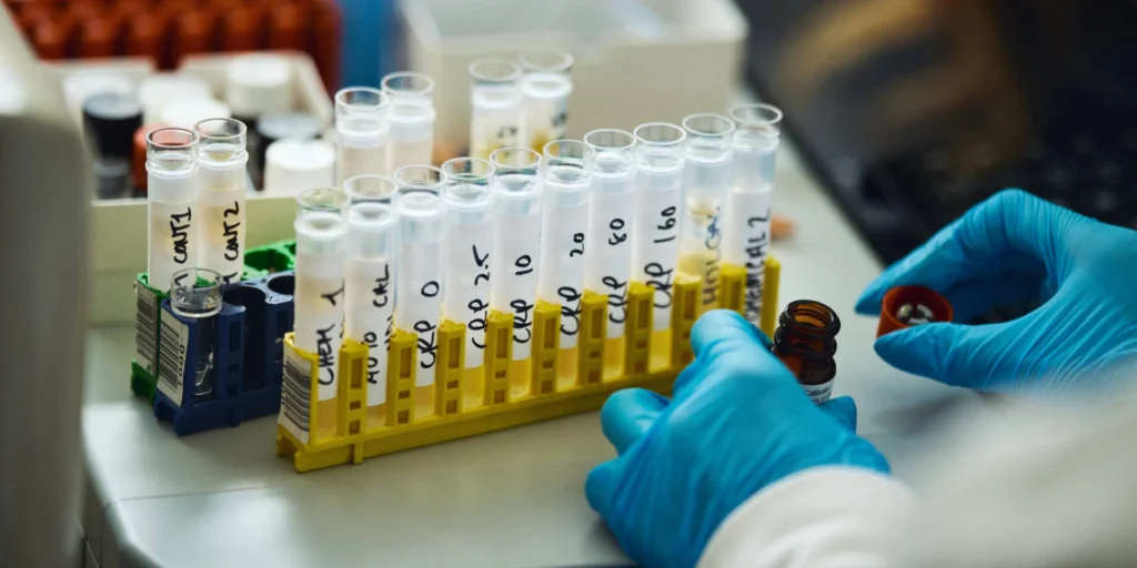 Hims & Hers Acquires At-Home Lab Testing Facility