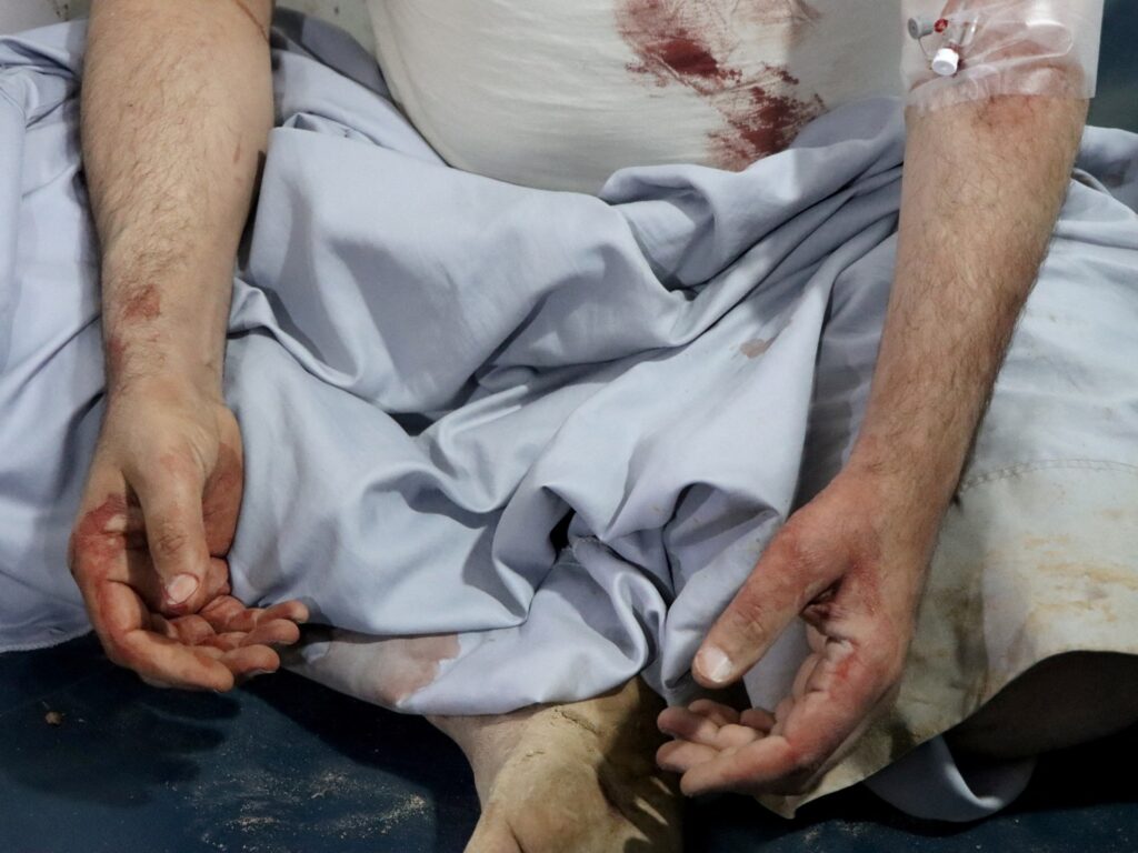 ‘Just like that’: Yemeni families destroyed by US air strikes | Israel-Palestine conflict News